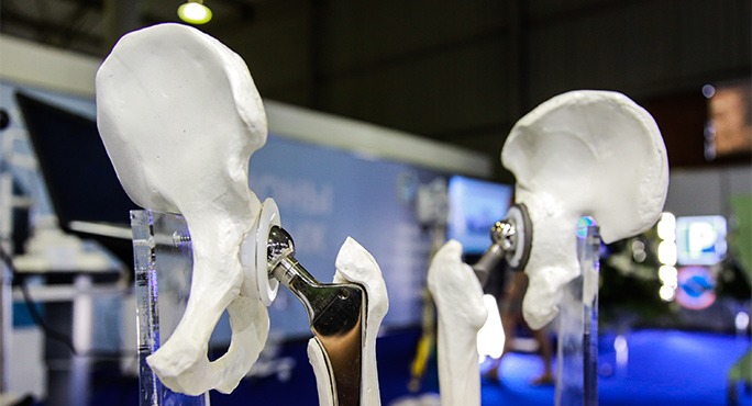 Крупнейшее российское производство имплантатов для травматологии запустили в Новосибирске